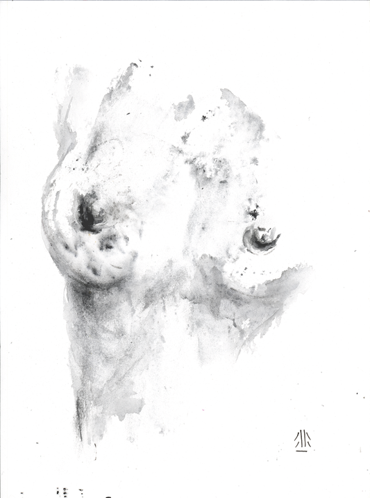 body 9
